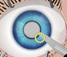 Göz Ameliyatı